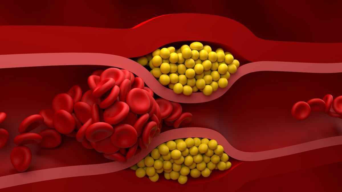 Cholesterin-schwankungen: das unterschätzte risiko für ihr herz