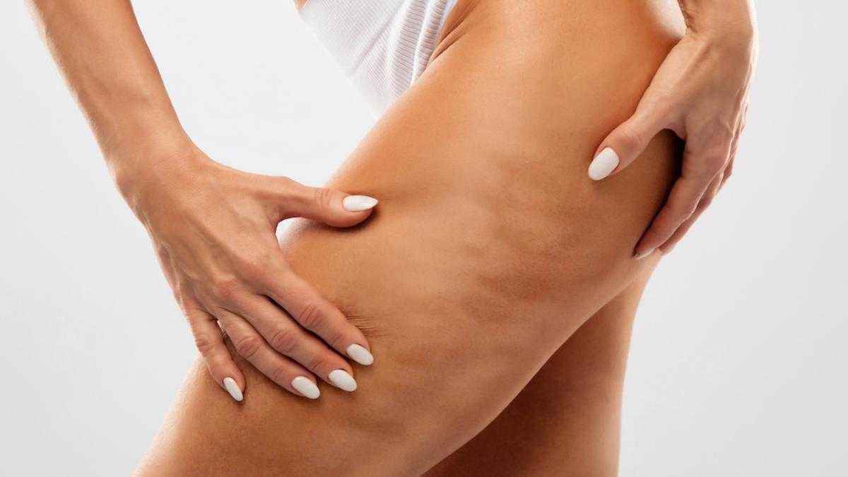 Durchbruch in der sportmedizin: wissenschaftlich validierte mittel gegen cellulitis!