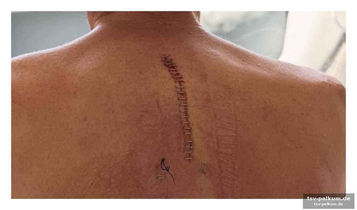 Die folgen des dramatischen unfalls
