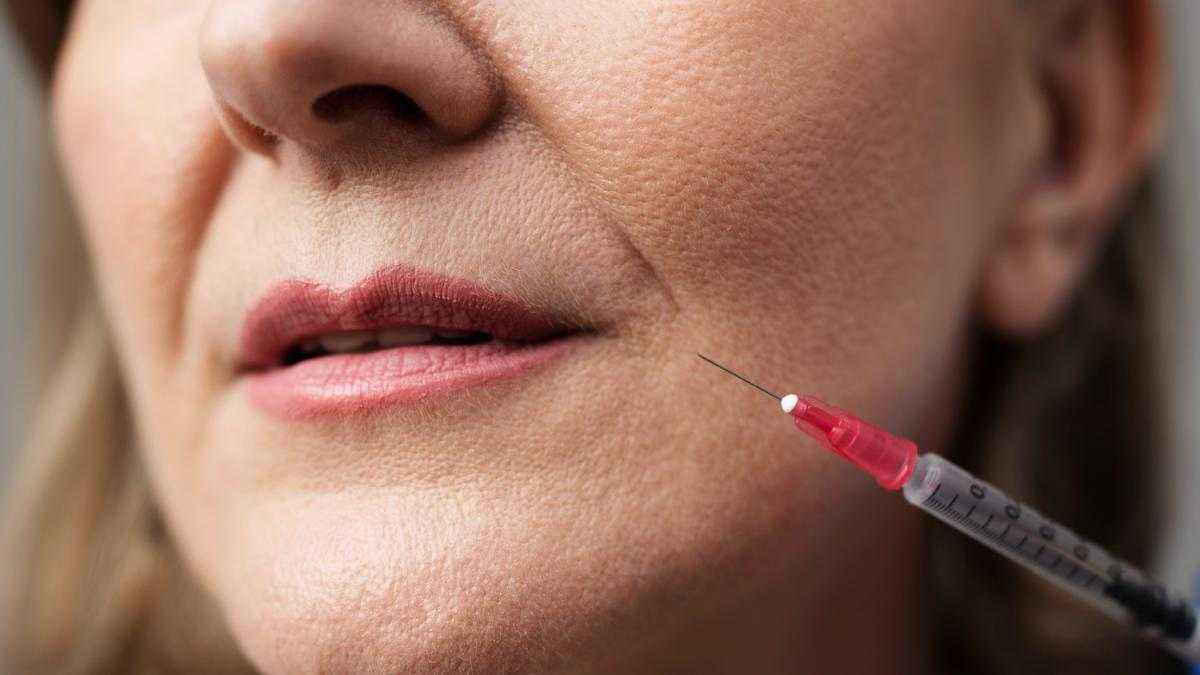 Gesichtsbehandlungen: wenn filler-fails zu teuren korrekturen führen