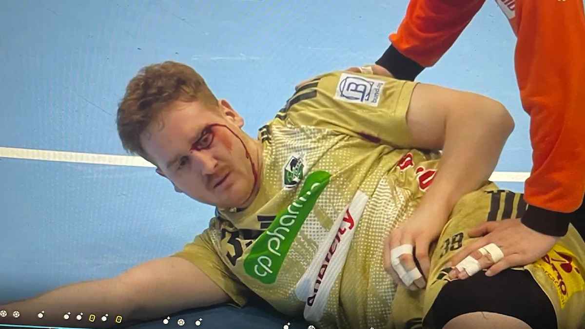 Handball-eskalation: blut, platzverweise und ein klarer sieg für hannover-burgdorf