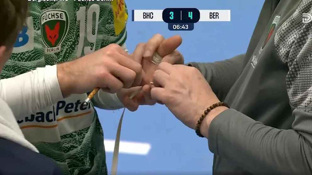 Handball-star gidsel repariert sich selbst: ungewöhnliche lösung bei fingerverletzung