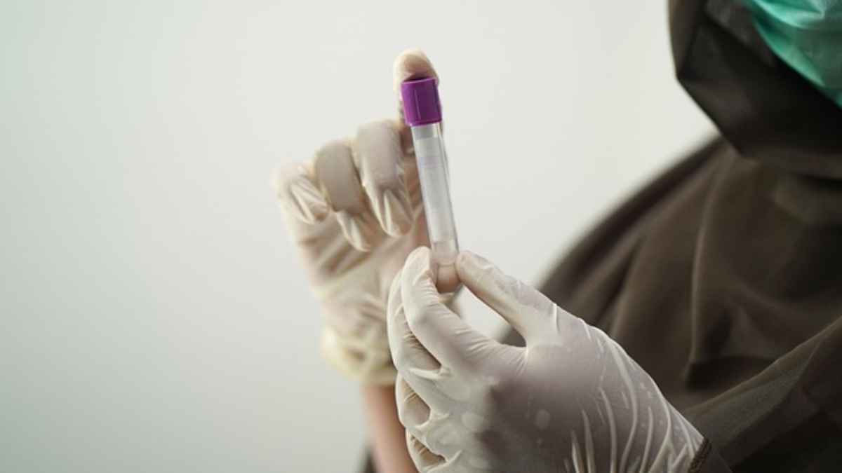 Hantavirus-ausbruch: so schnell und präzise werden jetzt tests durchgeführt