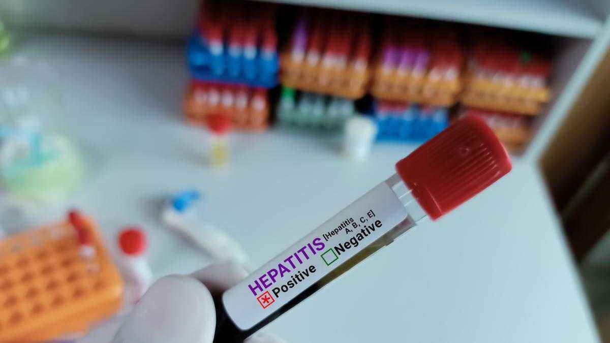 Hepatitis-a-explosion in italien: 42 % mehr infektionen in nur drei monaten