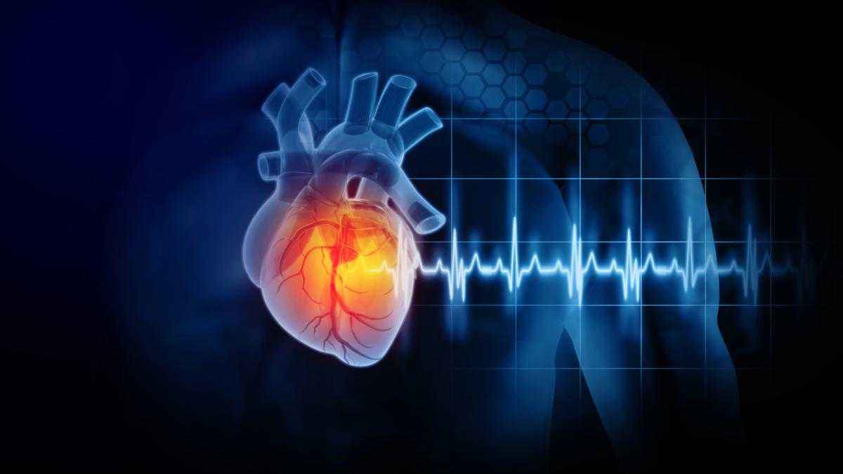 Herzinfarkt im stillen: 45% bleiben unentdeckt – eine tickende zeitbombe?