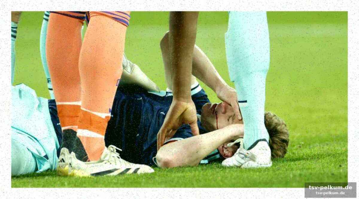 Kimmichs lippe, wirtz’ lächeln und das nagelsmann-experiment