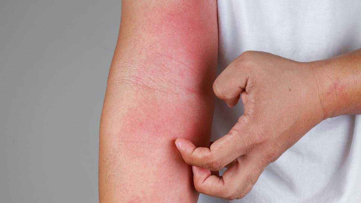 Kitzeln im kopf: warum psyche und haut an einem strang ziehen