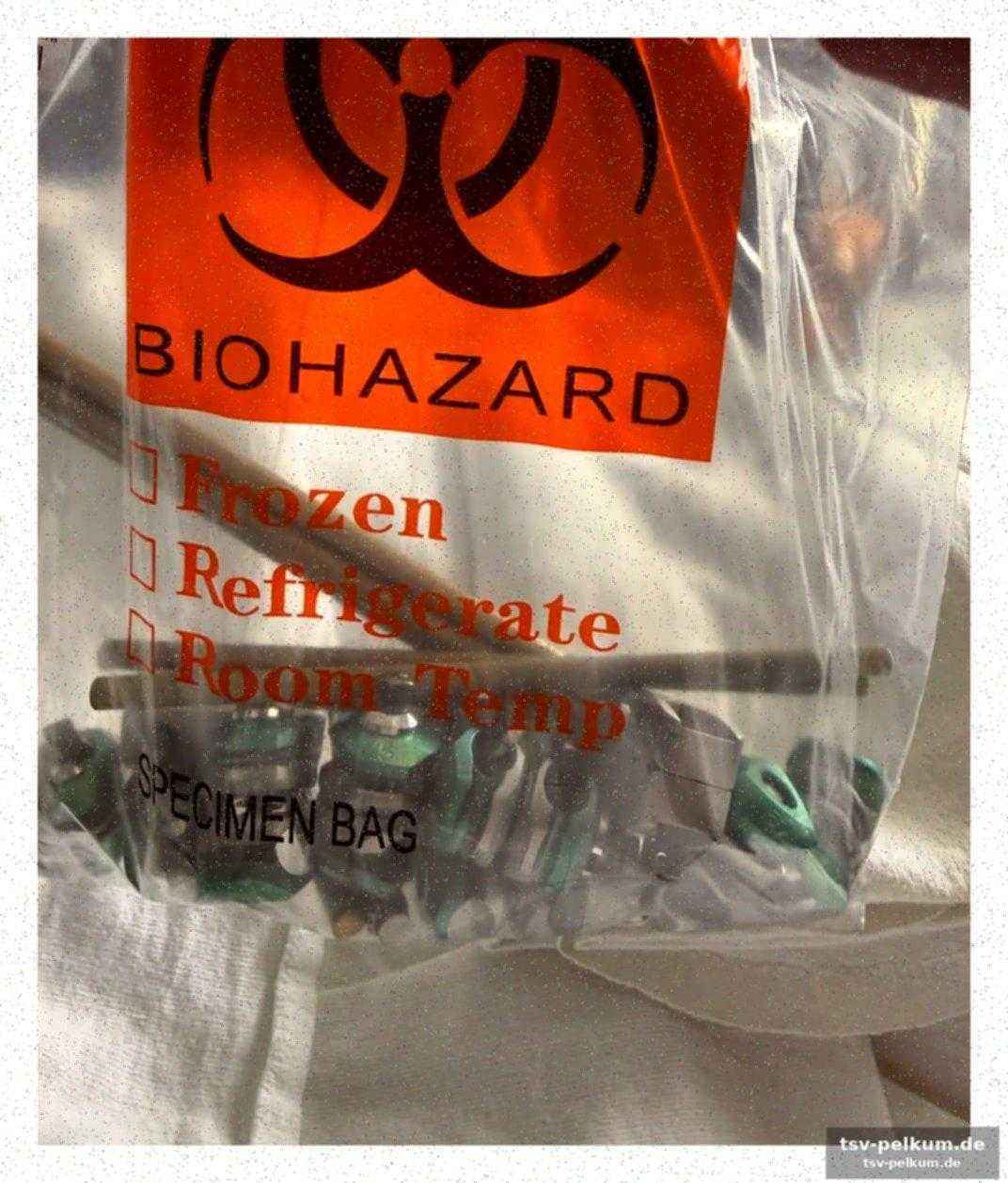 Die detaillierte operation im überblick