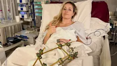 Lindsey vonn nach sturz: chefarzt enthüllt details zur operation
