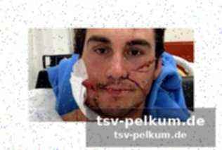 Expertenmeinung: neureuther warnt vor der brutalität der strecke