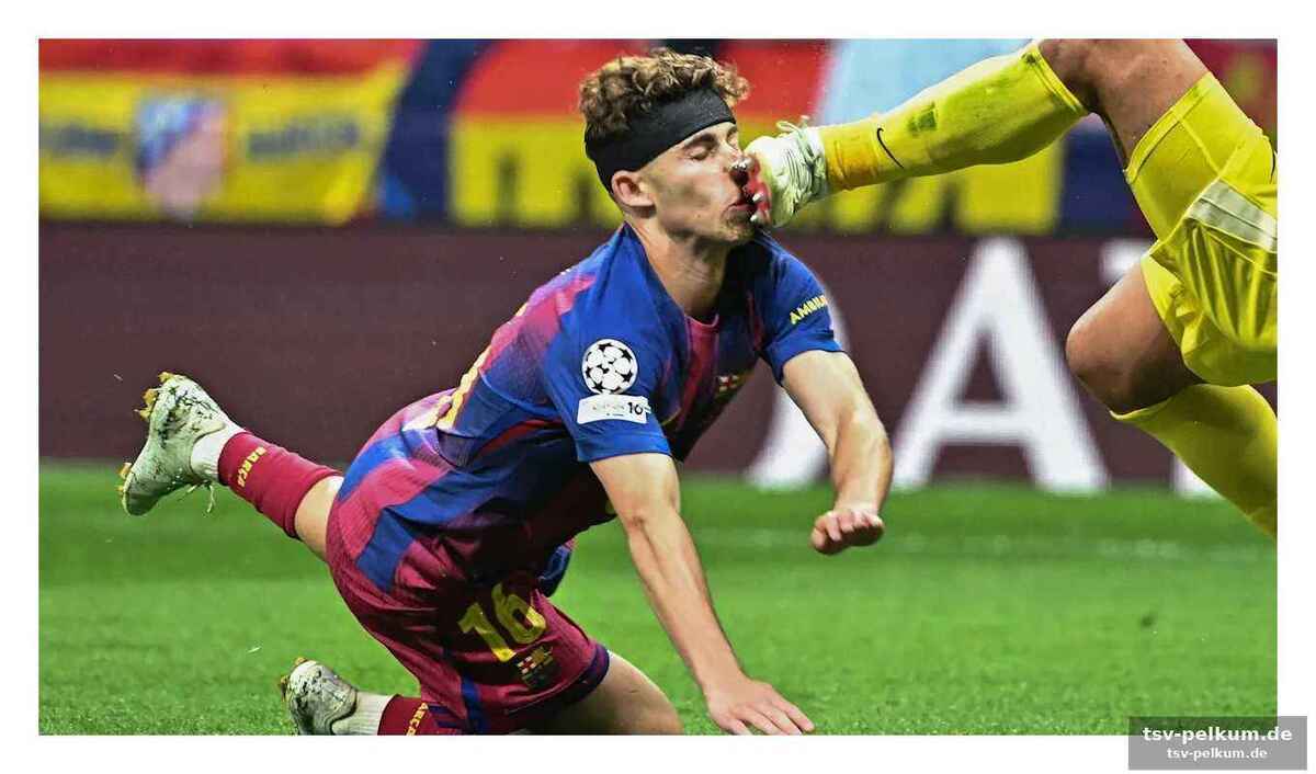 Verletzungswelle überschattet barça-offensive