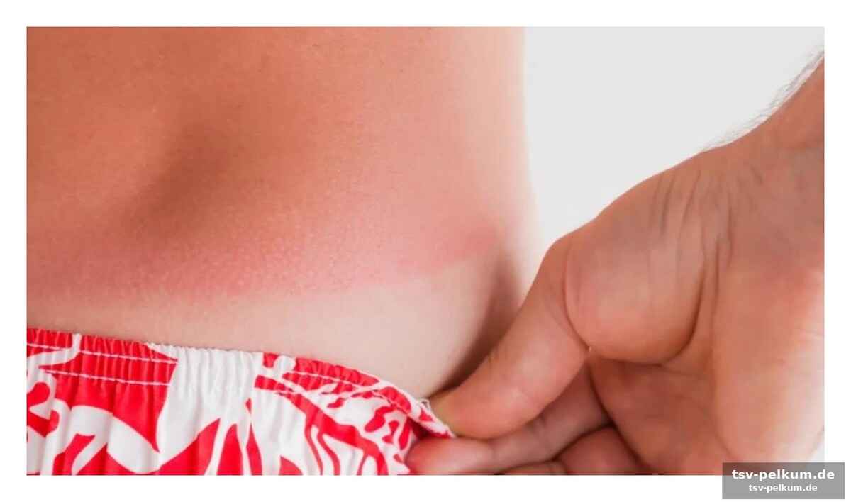 Die gefährliche illusion der sonnenbräune