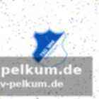 Personalsorgen vor dem bayern-spiel